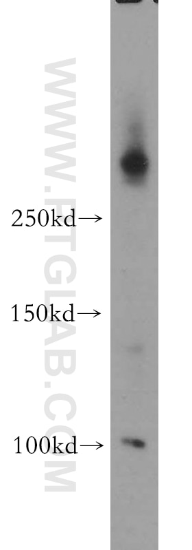 WB analysis of mouse thymus using 20681-1-AP