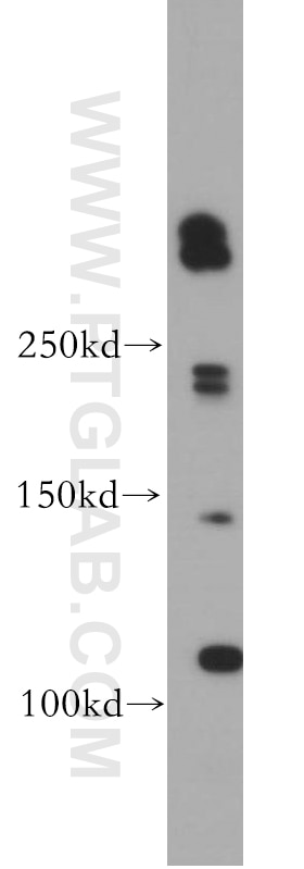 Western Blot (WB) analysis of L02 cells using ABCA2 Polyclonal antibody (20681-1-AP)