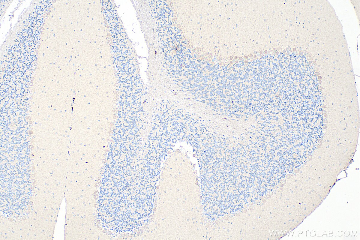 Immunohistochemistry (IHC) staining of mouse cerebellum tissue using ABCA3 Polyclonal antibody (27450-1-AP)