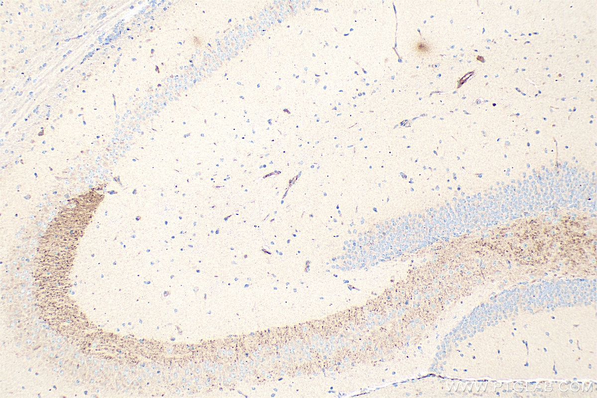 Immunohistochemistry (IHC) staining of mouse brain tissue using ABCA3 Polyclonal antibody (27450-1-AP)