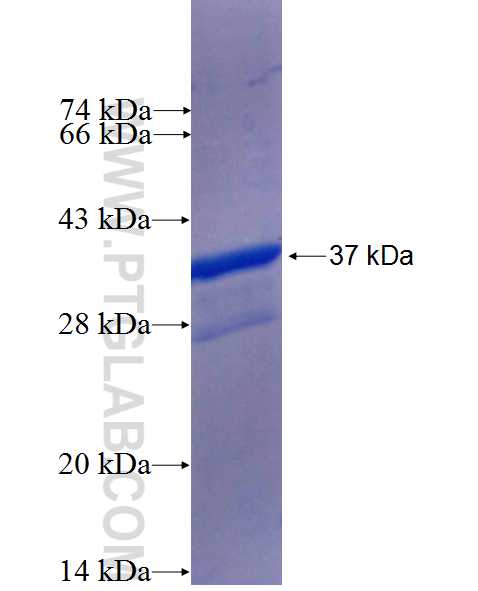 ABCA3 fusion protein Ag24749 SDS-PAGE