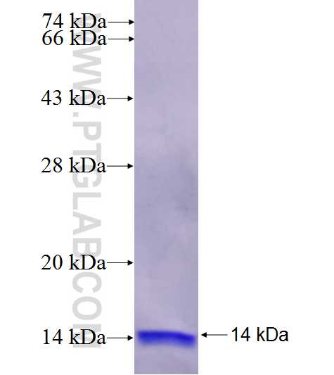 ABCA3 fusion protein Ag24759 SDS-PAGE