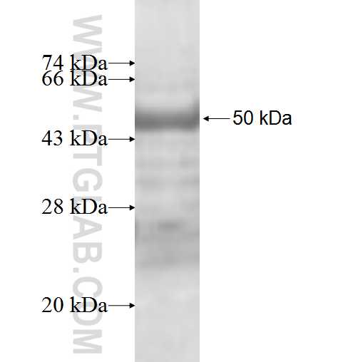 ABCA3 fusion protein Ag9840 SDS-PAGE