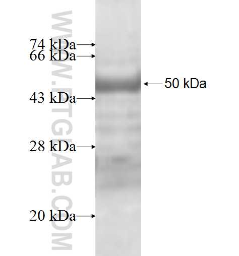 ABCA3 fusion protein Ag9840 SDS-PAGE ABCA3 fusion protein Ag9840 SDS-PAGE