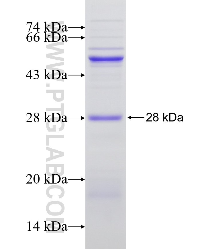 ABCA5 fusion protein Ag21956 SDS-PAGE