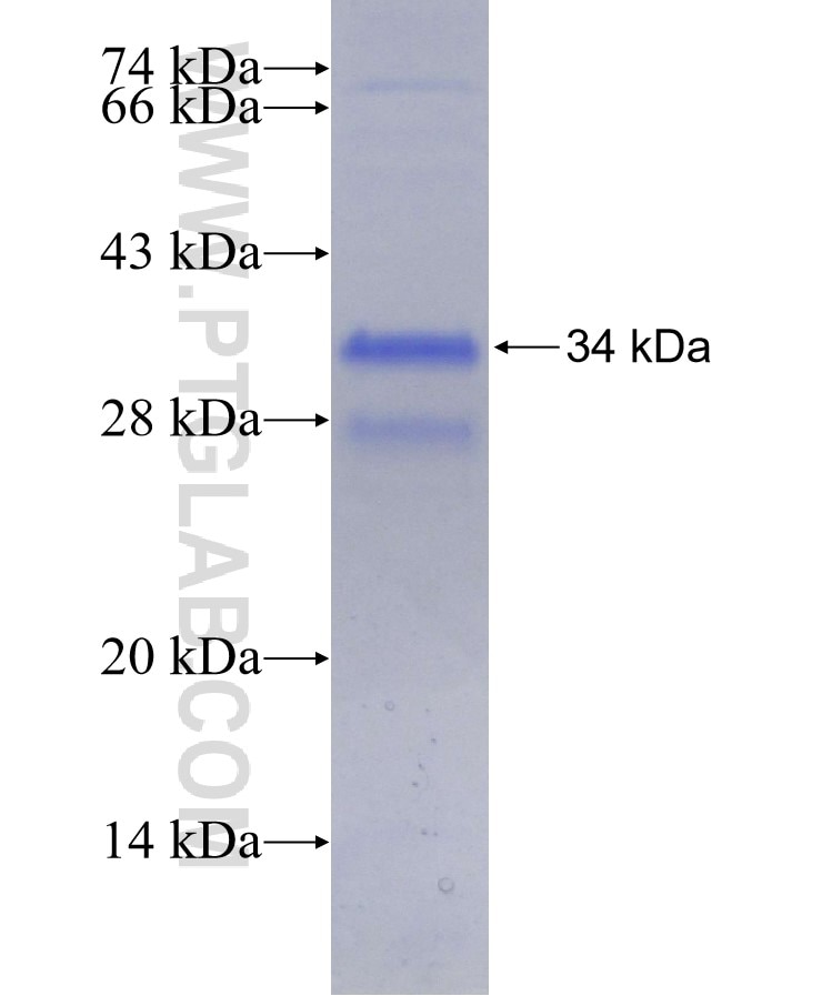 ABCA6 fusion protein Ag29524 SDS-PAGE