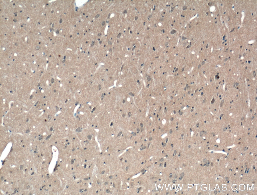 Immunohistochemistry (IHC) staining of rat brain tissue using ABCA7 Polyclonal antibody (25339-1-AP)