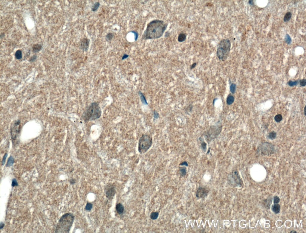 Immunohistochemistry (IHC) staining of rat brain tissue using ABCA7 Polyclonal antibody (25339-1-AP)