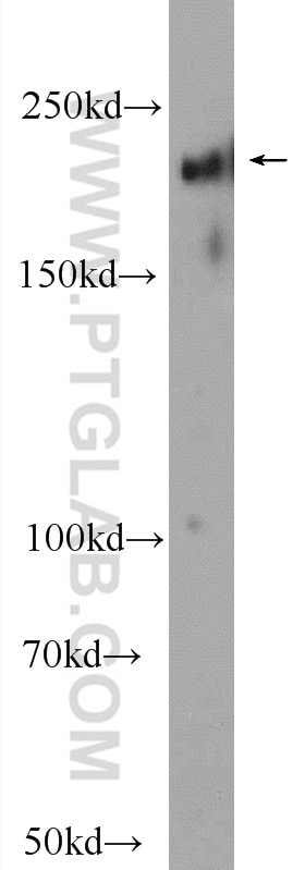 Western Blot (WB) analysis of mouse brain tissue using ABCA7 Polyclonal antibody (25339-1-AP)