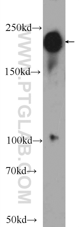 WB analysis of mouse brain using 25339-1-AP