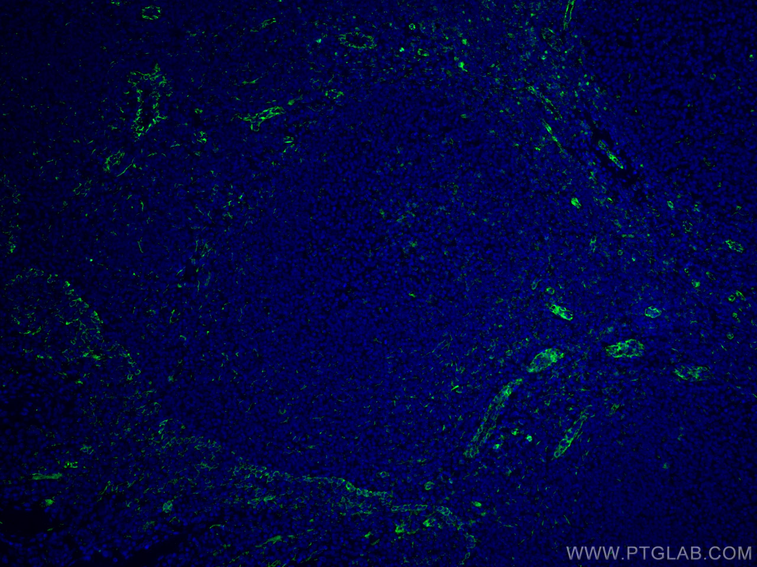Immunofluorescence (IF) / fluorescent staining of human tonsillitis tissue using ABCA7 Monoclonal antibody (67128-1-Ig)