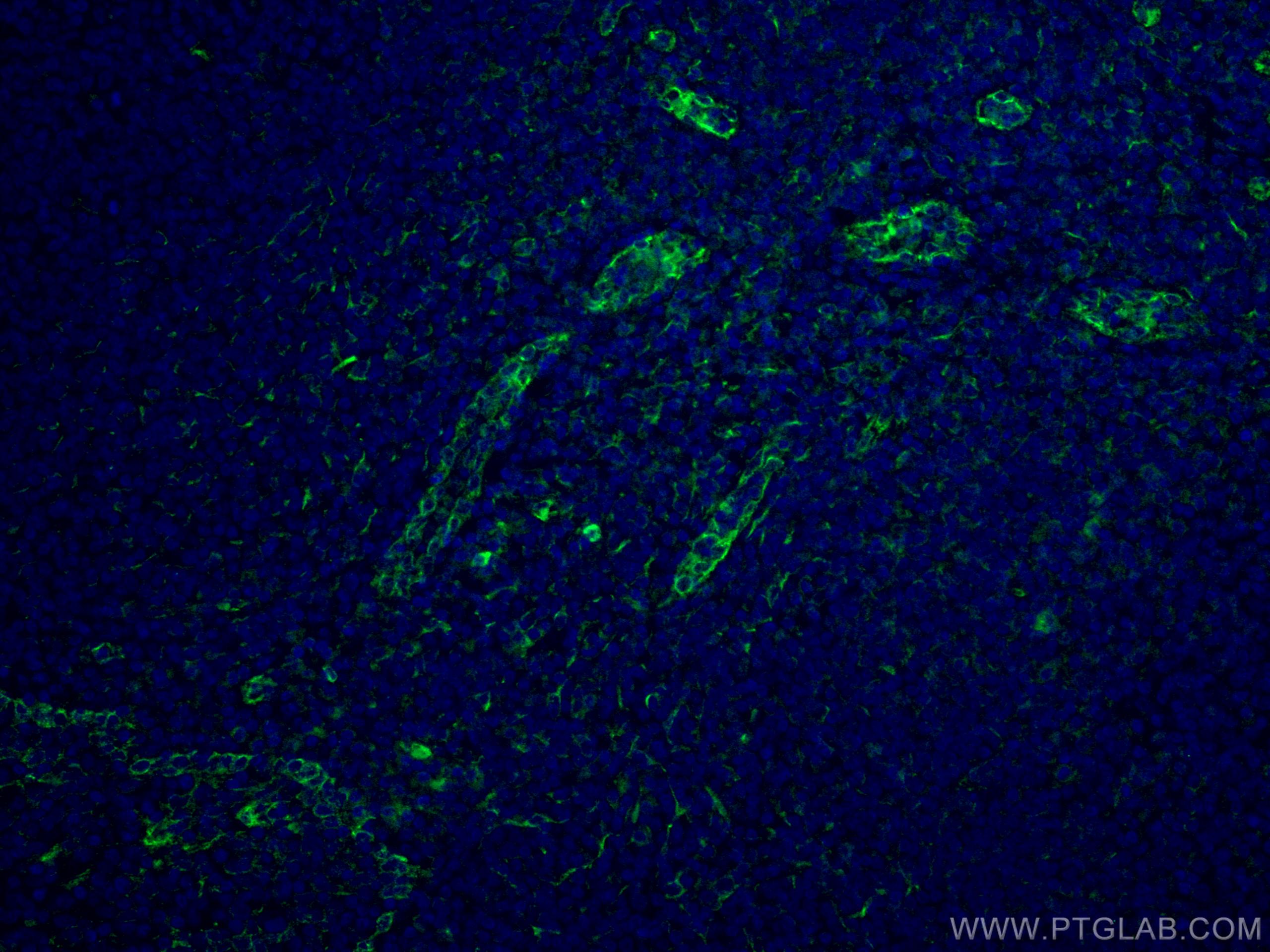 Immunofluorescence (IF) / fluorescent staining of human tonsillitis tissue using ABCA7 Monoclonal antibody (67128-1-Ig)