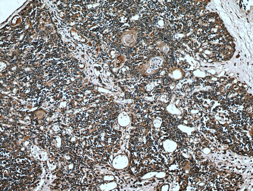 Immunohistochemistry (IHC) staining of human thymus tissue using ABCA7 Monoclonal antibody (67128-1-Ig)