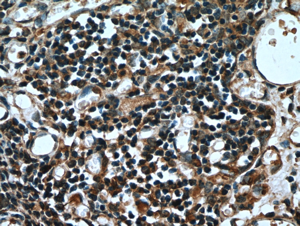 Immunohistochemistry (IHC) staining of human thymus tissue using ABCA7 Monoclonal antibody (67128-1-Ig)
