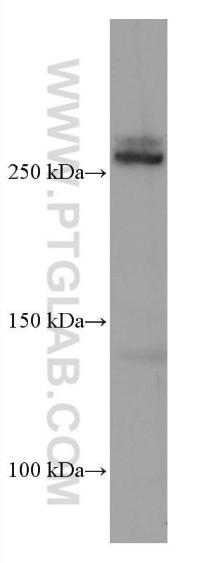 Western Blot (WB) analysis of Jurkat cells using ABCA7 Monoclonal antibody (67128-1-Ig)