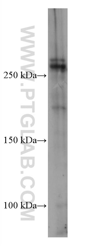 Western Blot (WB) analysis of pig thymus tissue using ABCA7 Monoclonal antibody (67128-1-Ig)