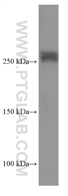 Western Blot (WB) analysis of rat brain tissue using ABCA7 Monoclonal antibody (67128-1-Ig)