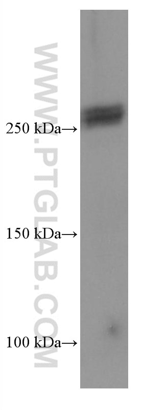 Western Blot (WB) analysis of mouse brain tissue using ABCA7 Monoclonal antibody (67128-1-Ig)