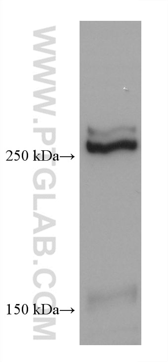 Western Blot (WB) analysis of pig brain tissue using ABCA7 Monoclonal antibody (67128-1-Ig)