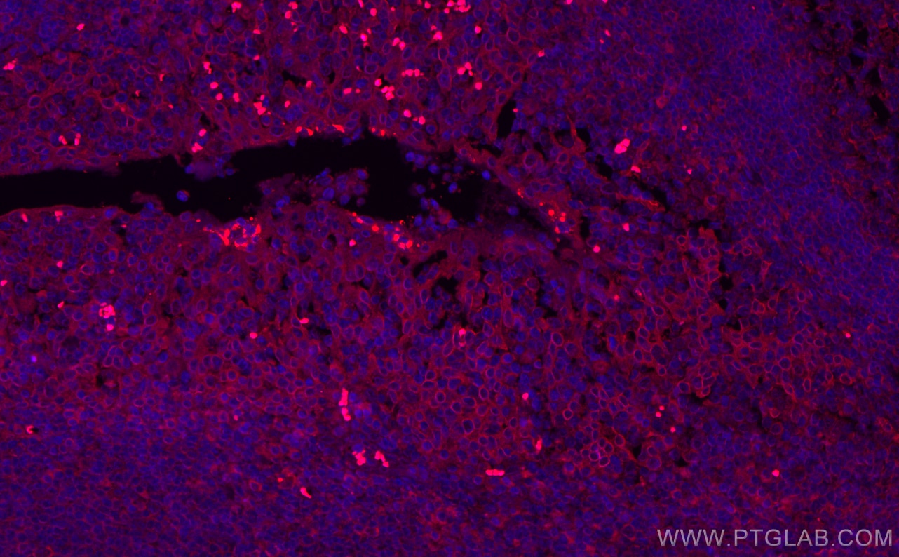 Immunofluorescence (IF) / fluorescent staining of human tonsillitis tissue using CoraLite®594-conjugated ABCA7 Monoclonal antibody (CL594-67128)