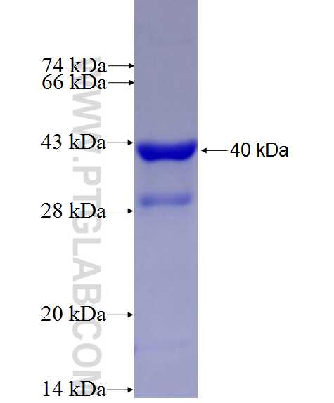 ABCA7 fusion protein Ag27485 SDS-PAGE