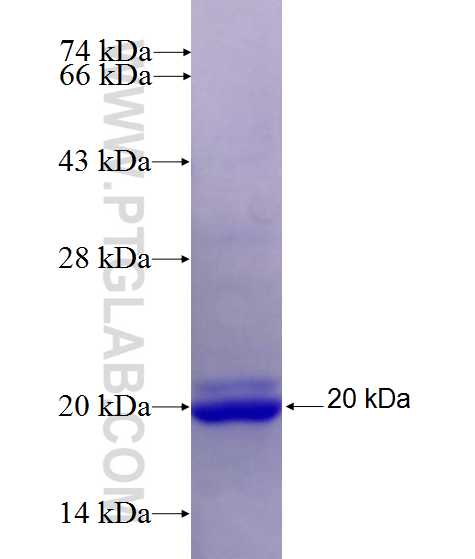 ABCA7 fusion protein Ag27499 SDS-PAGE