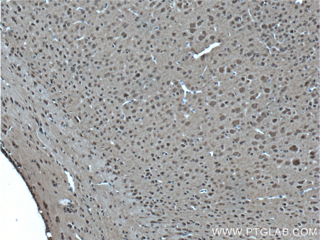 Immunohistochemistry (IHC) staining of mouse brain tissue using ABCA8 Polyclonal antibody (24351-1-AP)