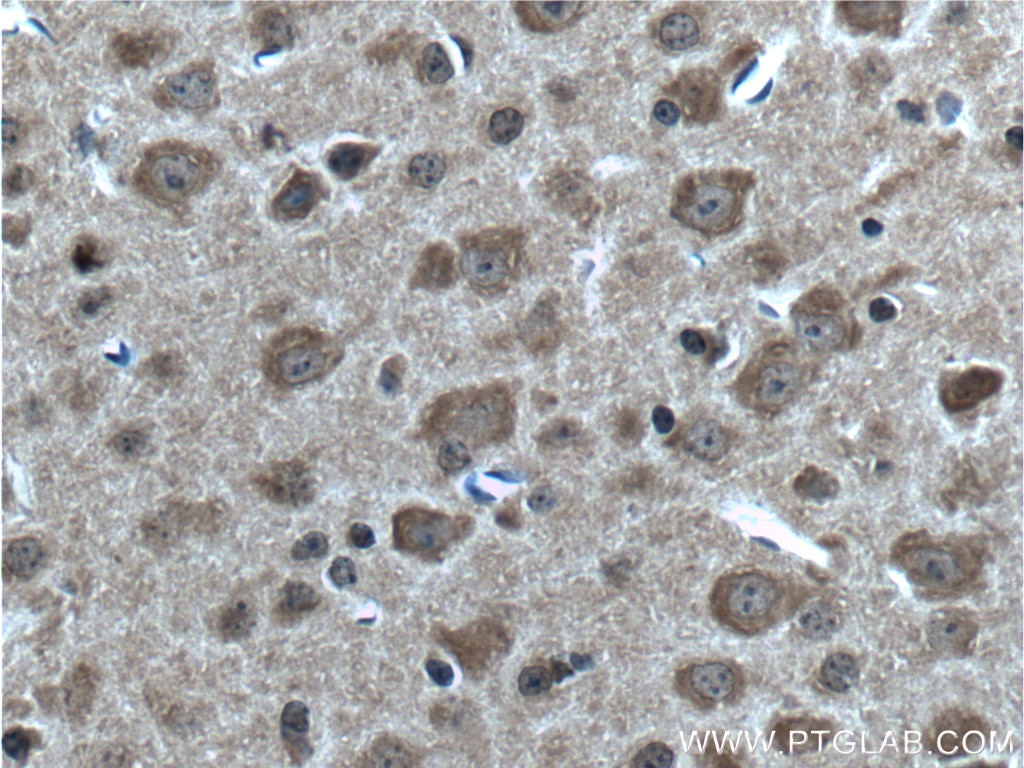 IHC staining of mouse brain using 24351-1-AP