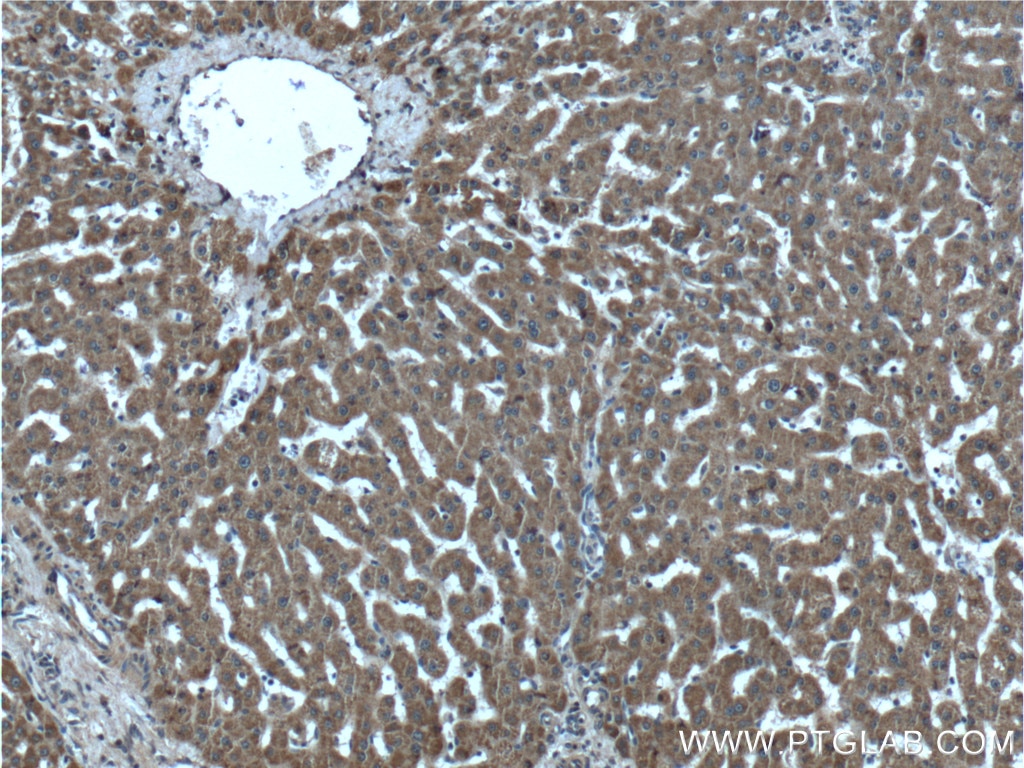 Immunohistochemistry (IHC) staining of human liver tissue using ABCA8 Polyclonal antibody (24351-1-AP)