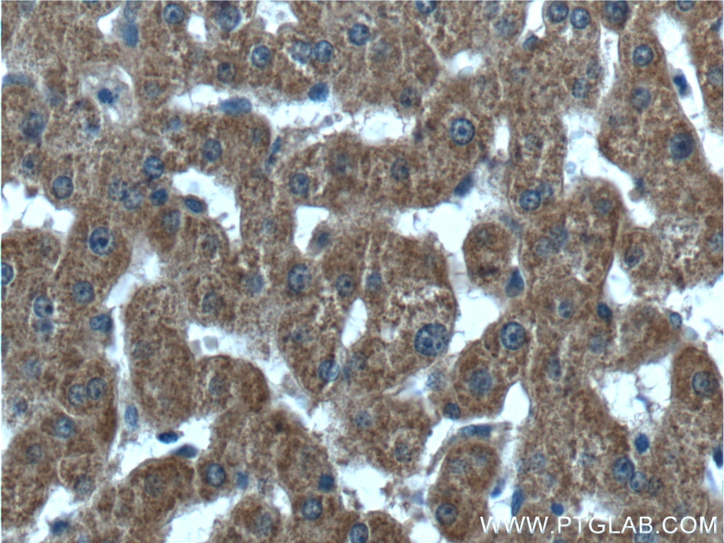 Immunohistochemistry (IHC) staining of human liver tissue using ABCA8 Polyclonal antibody (24351-1-AP)