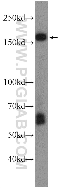 Western Blot (WB) analysis of mouse brain tissue using ABCA8 Polyclonal antibody (24351-1-AP)