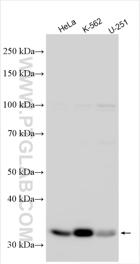 Western Blot (WB) analysis of various lysates using ABCA9 Polyclonal antibody (31194-1-AP)