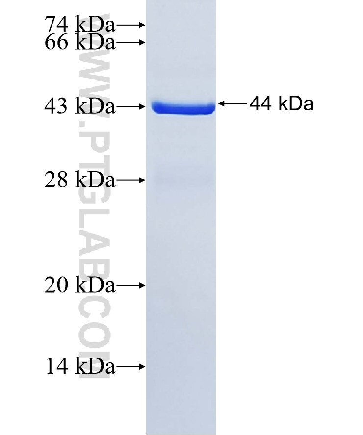 ABCA9 fusion protein Ag35032 SDS-PAGE