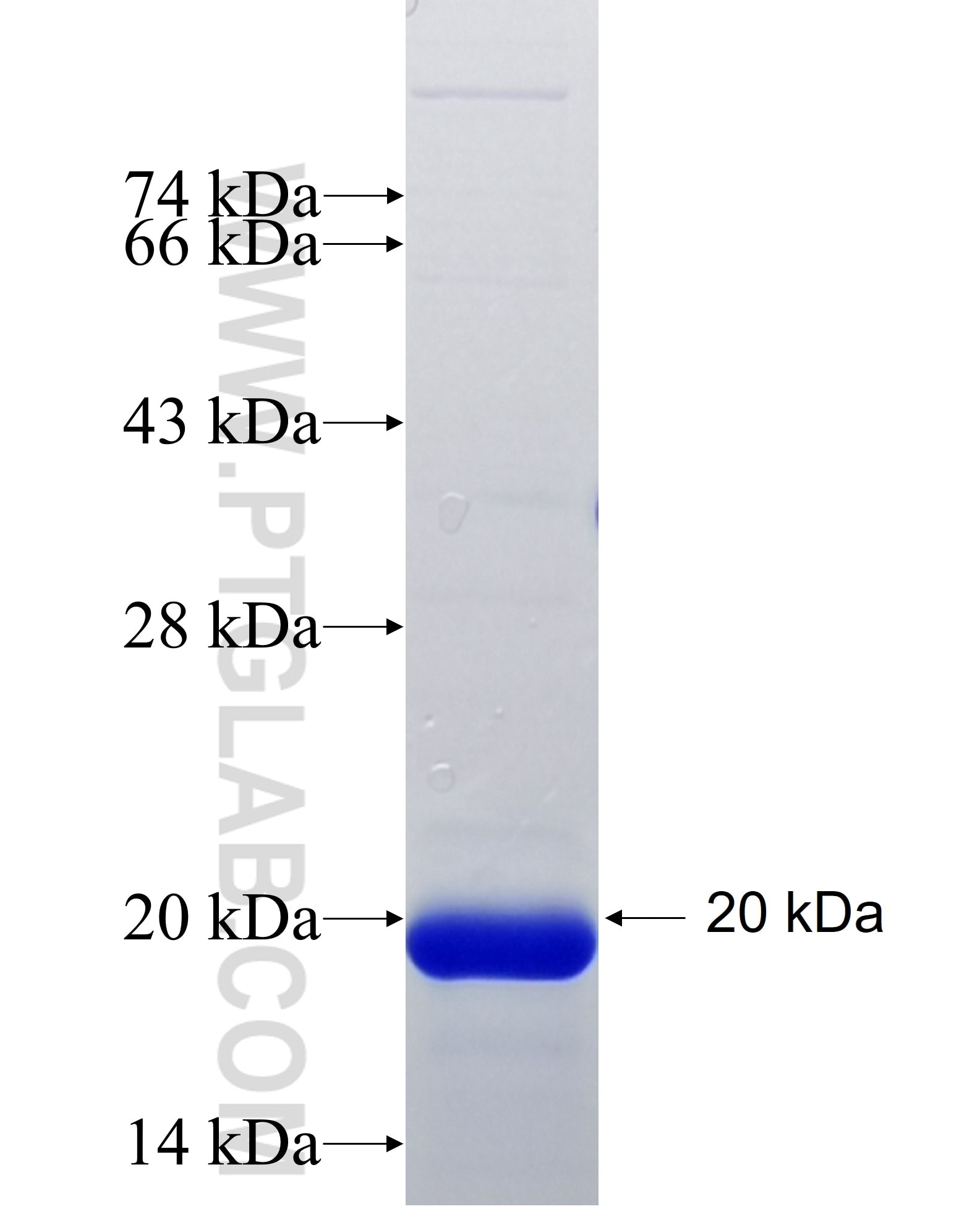 ABCA9 fusion protein Ag35045 SDS-PAGE ABCA9 fusion protein Ag35045 SDS-PAGE