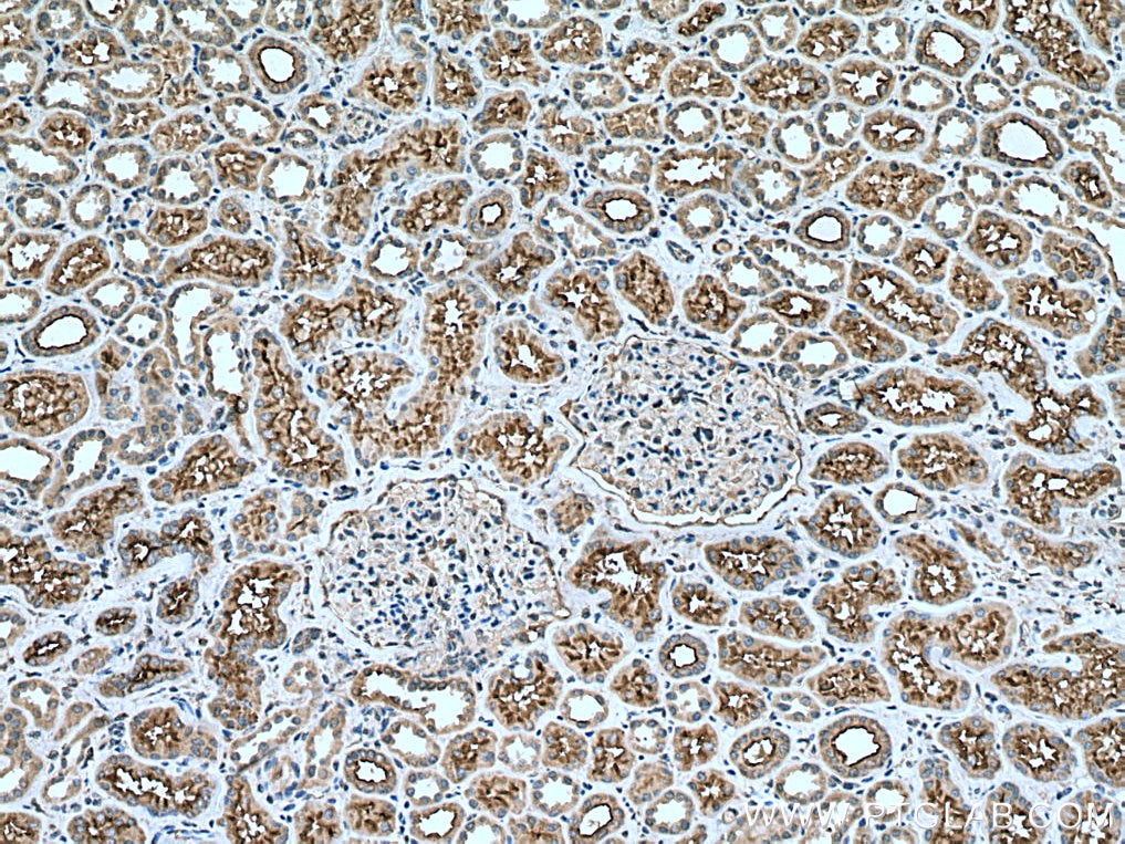 Immunohistochemistry (IHC) staining of human kidney tissue using P glycoprotein Polyclonal antibody (22336-1-AP)