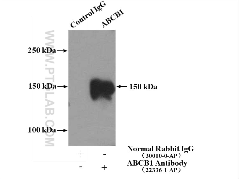 Immunoprecipitation (IP) experiment of human placenta tissue using P glycoprotein Polyclonal antibody (22336-1-AP)
