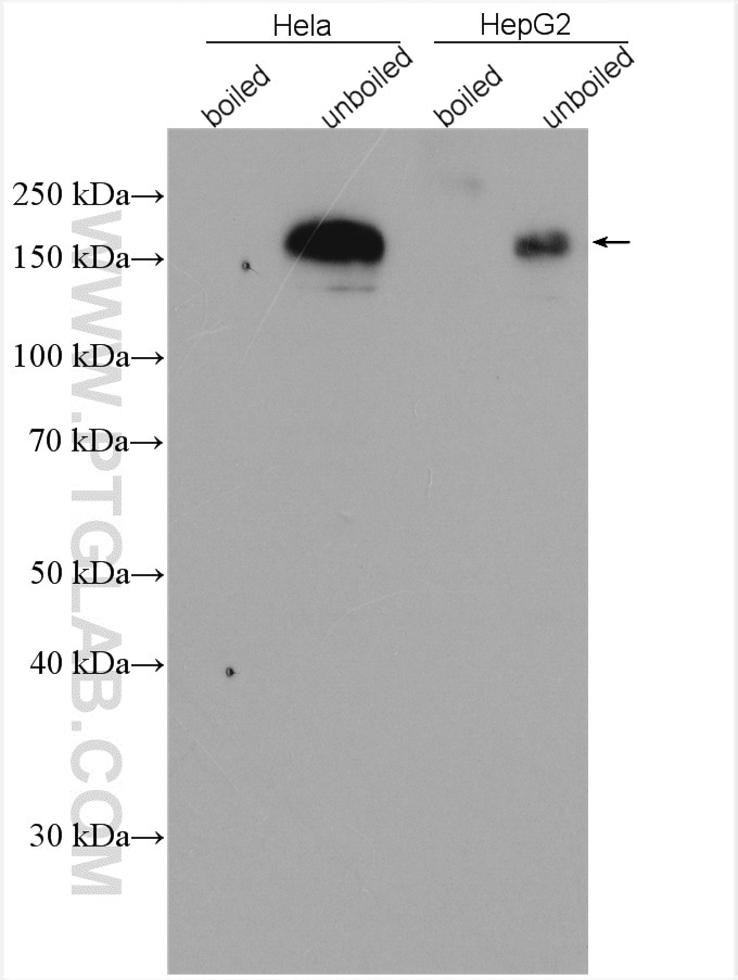 Western Blot (WB) analysis of various lysates using P glycoprotein Polyclonal antibody (22336-1-AP)