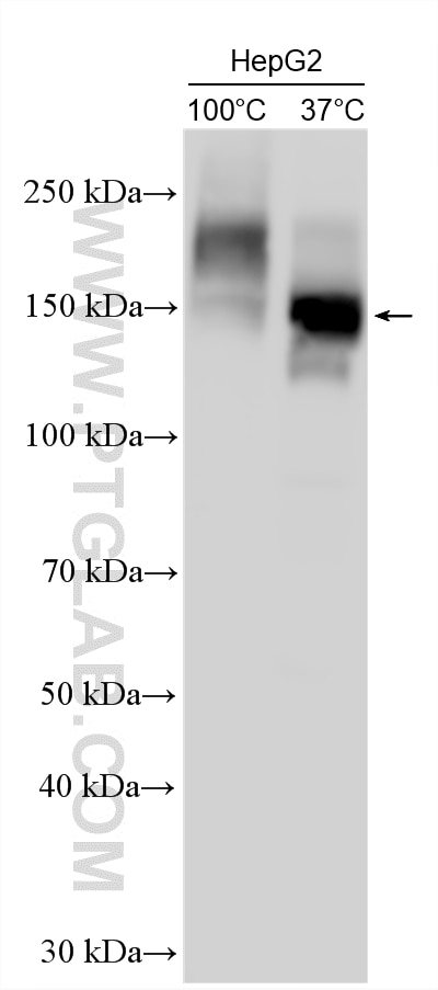 Western Blot (WB) analysis of various lysates using P glycoprotein Polyclonal antibody (22336-1-AP)