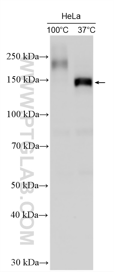 Western Blot (WB) analysis of various lysates using P glycoprotein Polyclonal antibody (22336-1-AP)