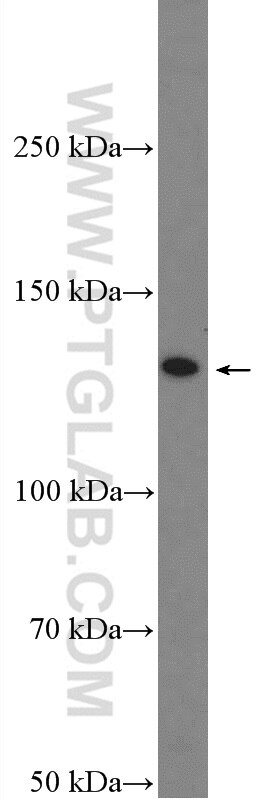 P glycoprotein Polyclonal antibody