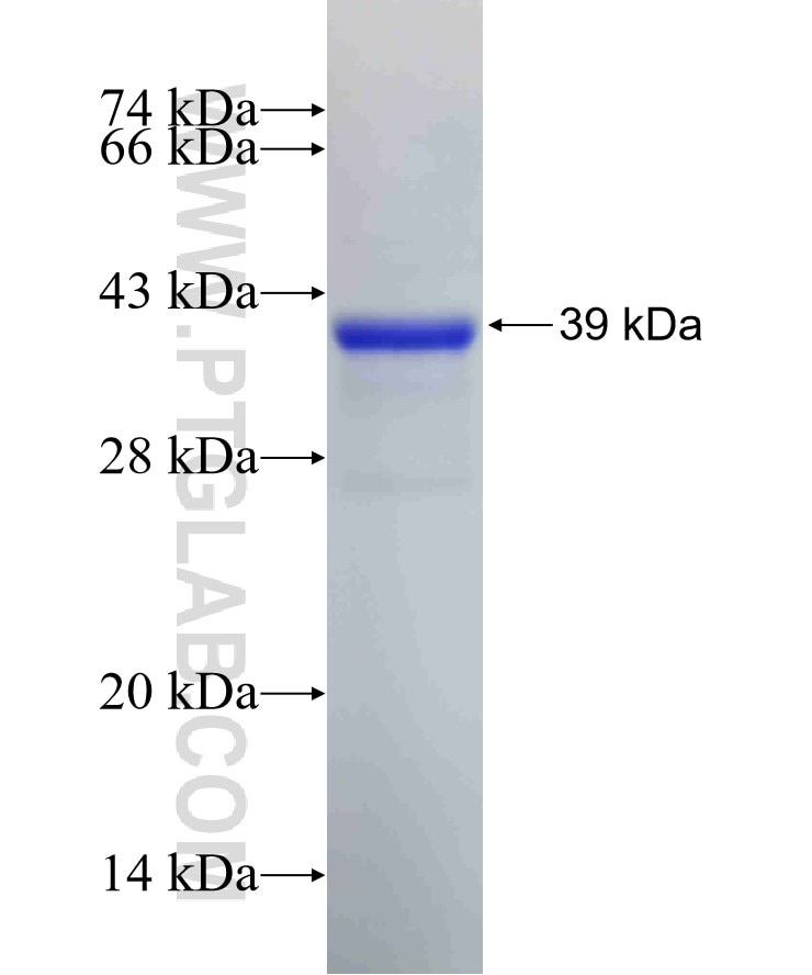 ABCB1 fusion protein Ag17811 SDS-PAGE