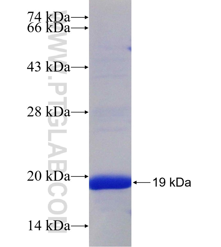 ABCB1 fusion protein Ag17895 SDS-PAGE