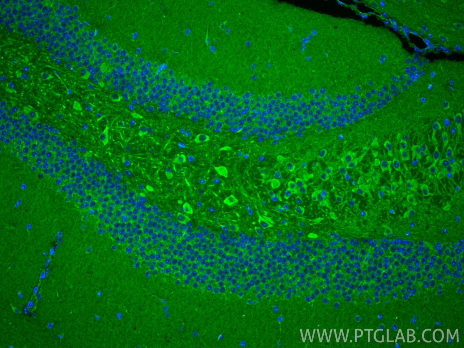 Immunofluorescence (IF) / fluorescent staining of mouse brain tissue using ABCB10 Polyclonal antibody (14628-1-AP)