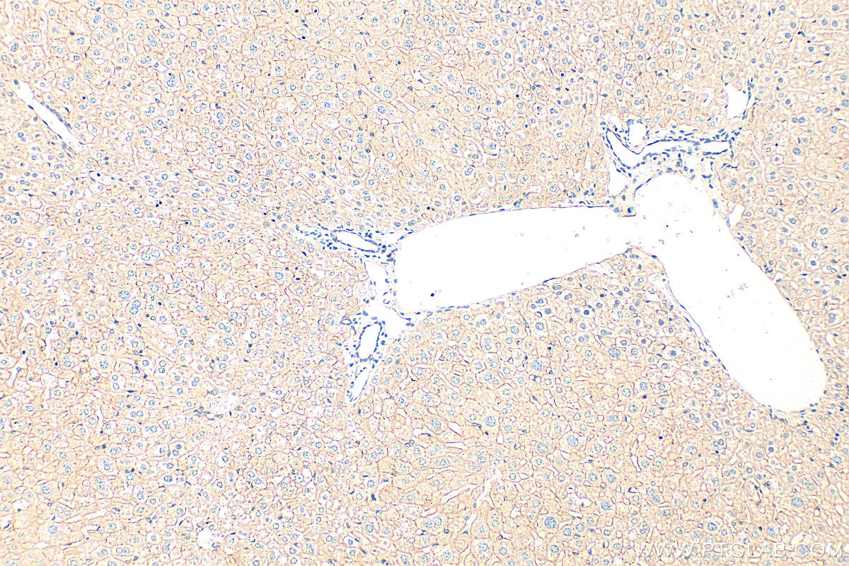 Immunohistochemistry (IHC) staining of mouse liver tissue using ABCB10 Polyclonal antibody (14628-1-AP)