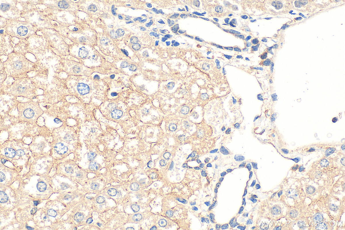 Immunohistochemistry (IHC) staining of mouse liver tissue using ABCB10 Polyclonal antibody (14628-1-AP)