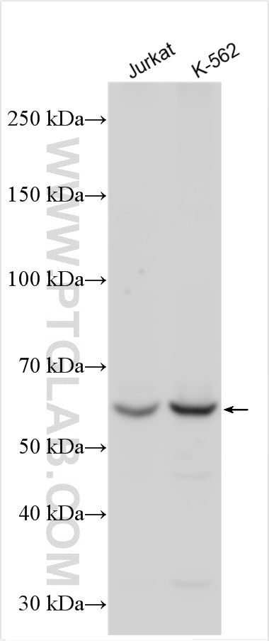Western Blot (WB) analysis of various lysates using ABCB10 Polyclonal antibody (14628-1-AP)