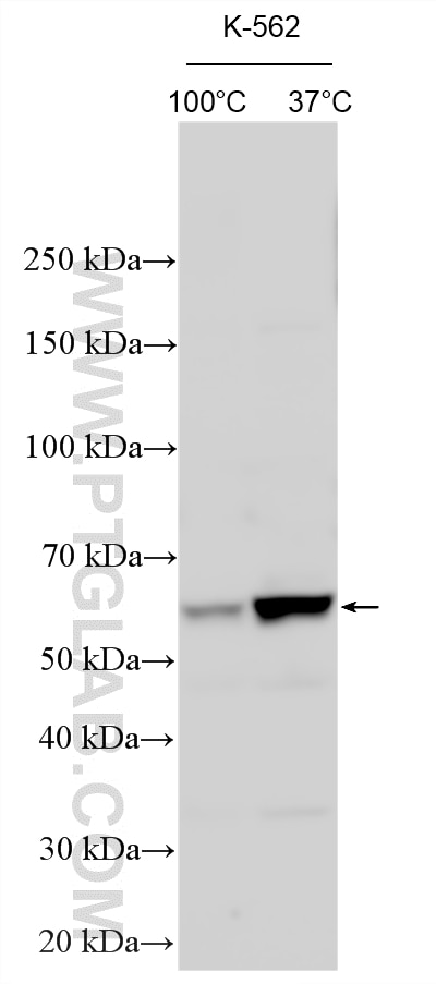 Western Blot (WB) analysis of various lysates using ABCB10 Polyclonal antibody (14628-1-AP)