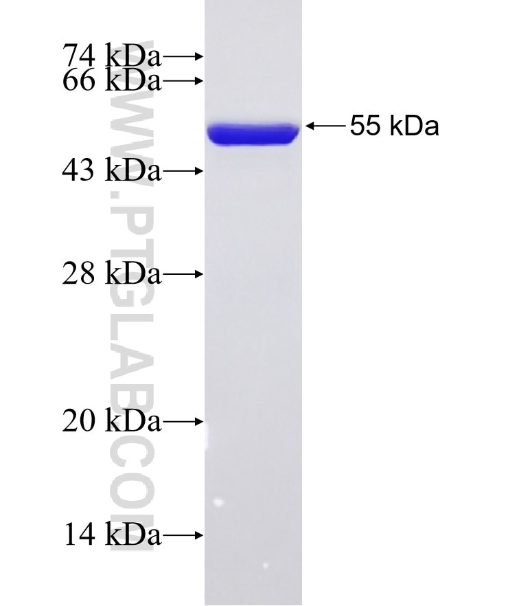 ABCB10 fusion protein Ag6203 SDS-PAGE