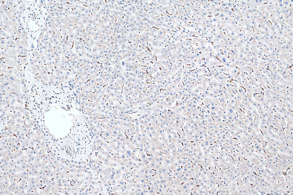 Immunohistochemistry (IHC) staining of human liver tissue using BSEP Polyclonal antibody (18990-1-AP)