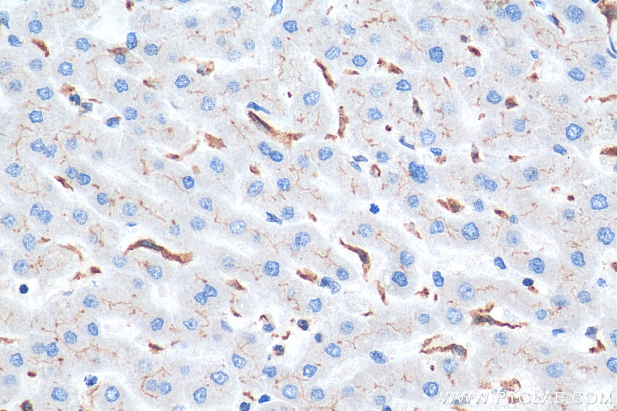 Immunohistochemistry (IHC) staining of human liver tissue using BSEP Polyclonal antibody (18990-1-AP)